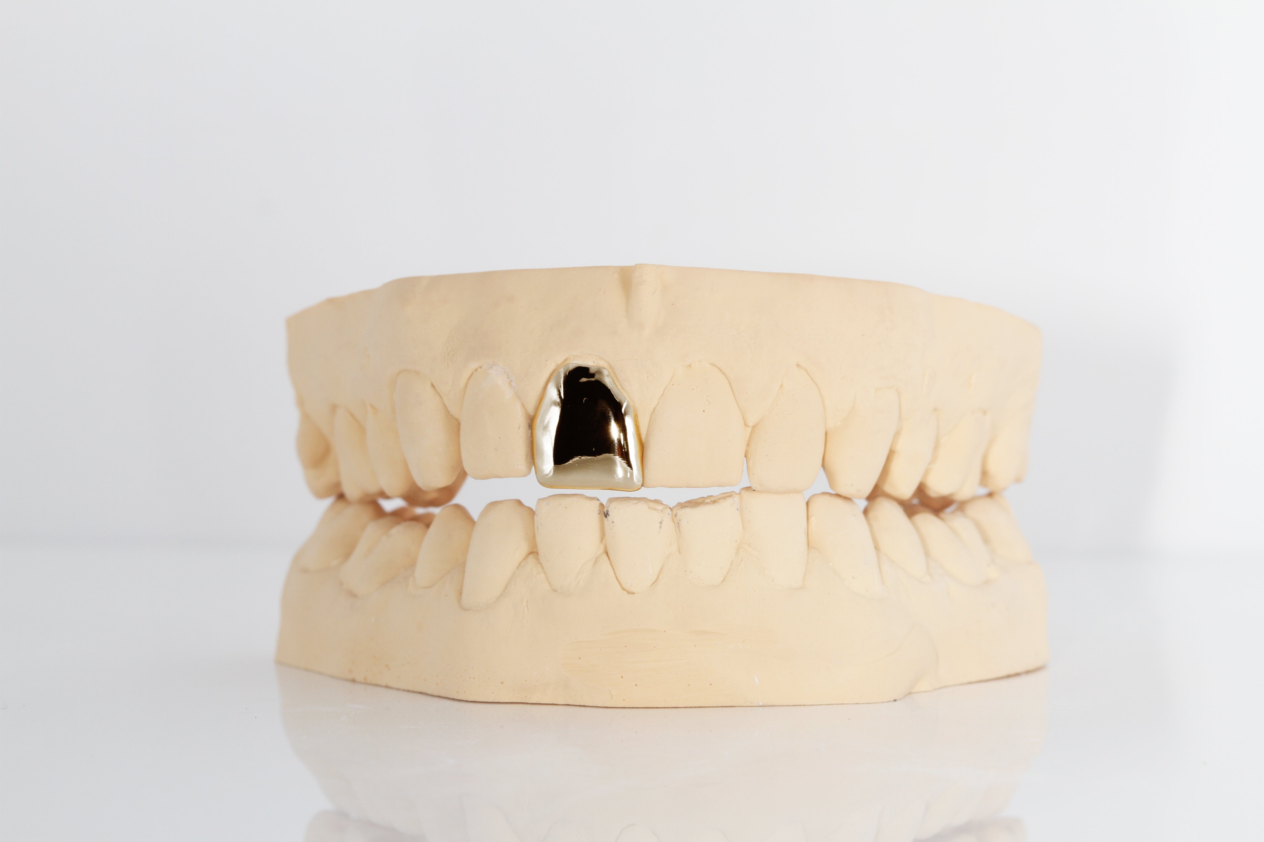 Grill "Yellow 1"